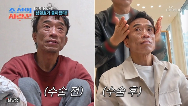 Shim Kwon Ho's Health Update After Liver Cancer Surgery