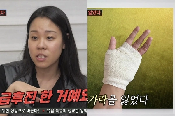 Insooni's Daughter Reveals Finger Surgery Story