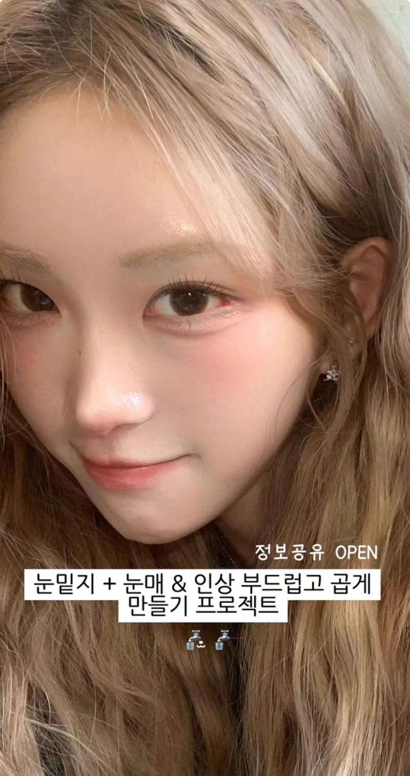 Choi Junhee's Pre-May Wedding Procedure Sparks Buzz