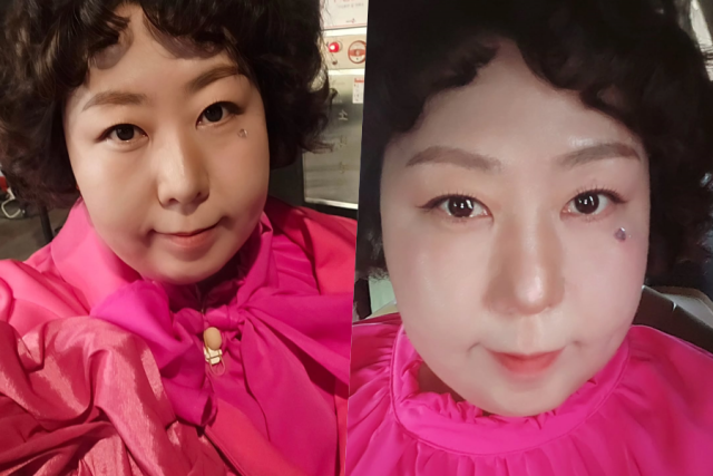 신기루, 눈 밑 쥐젖 해명