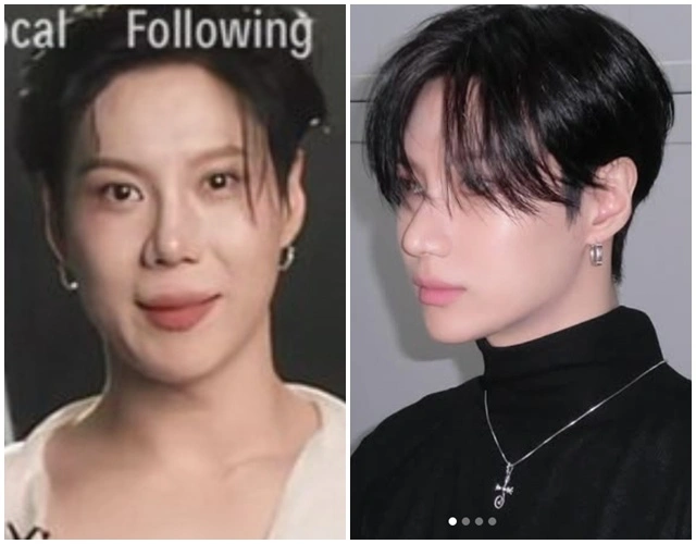 SHINee Taemin Plastic Surgery Rumors Emerge