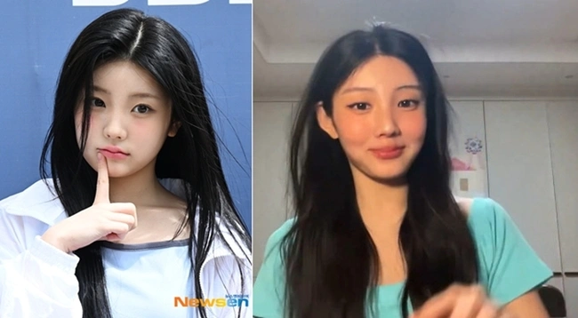 아일릿 원희, 볼살 실종 사태