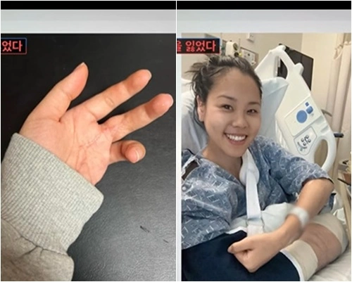 インスニ娘、小指手術を告白