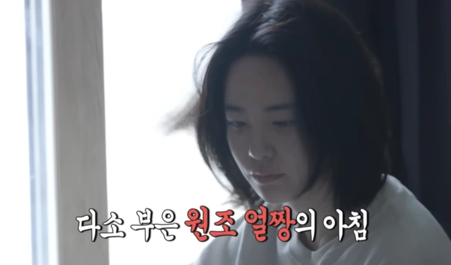 이주연, 부은 얼굴 근황 공개