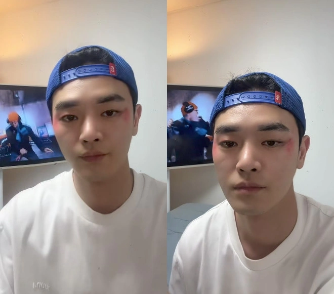 장동주, 30억 빚 상환 은퇴 이유