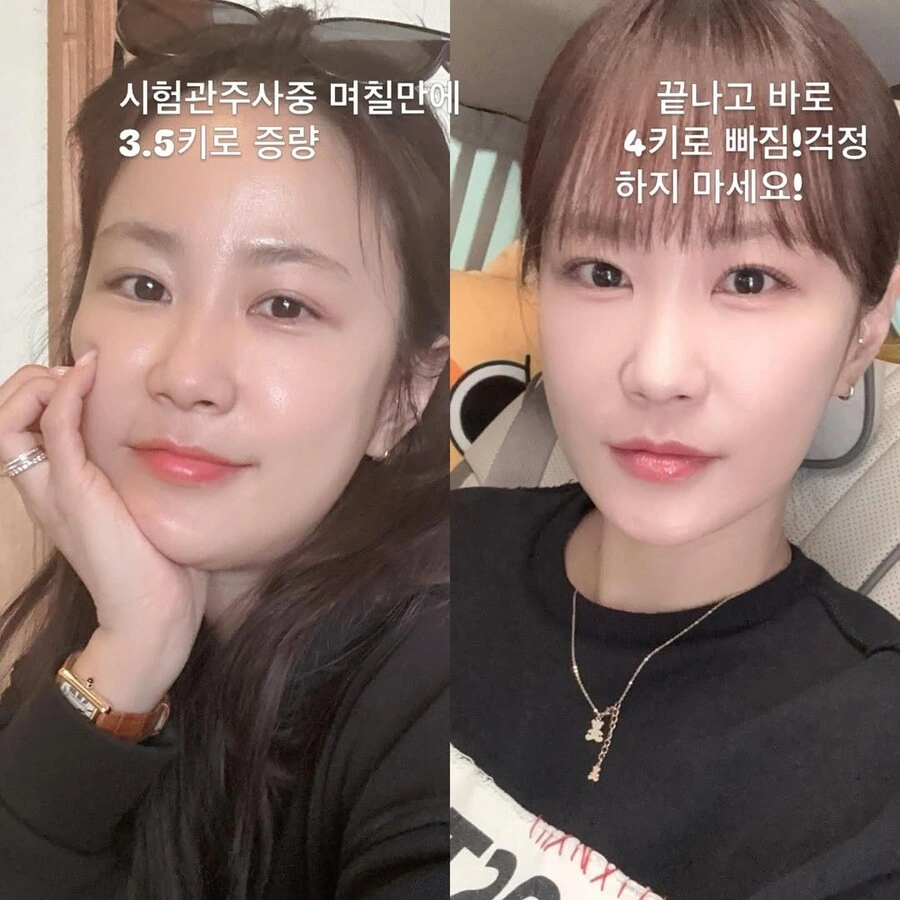 김지민 시험관 부작용 고백