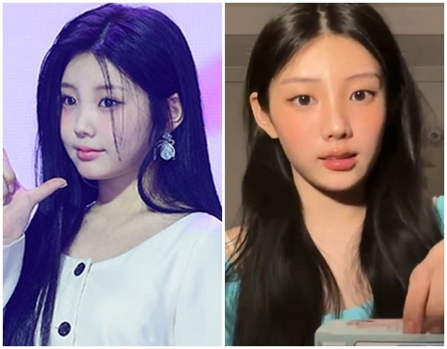 ILLIT Wonhee's Cheeks Disappear: Fans Concerned