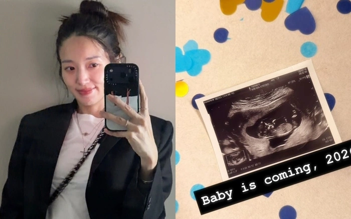 46세 김민경 임신 고민 토로