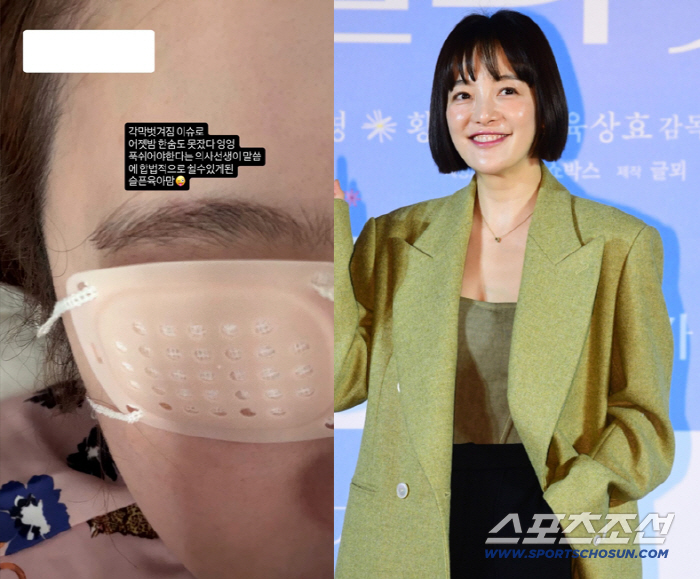 Hwang Bo-ra, corneal damage from wearing an eye patch