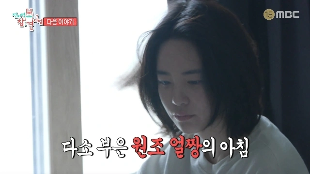 Lee Jooyeon's Swollen Face Shock, Home Condition